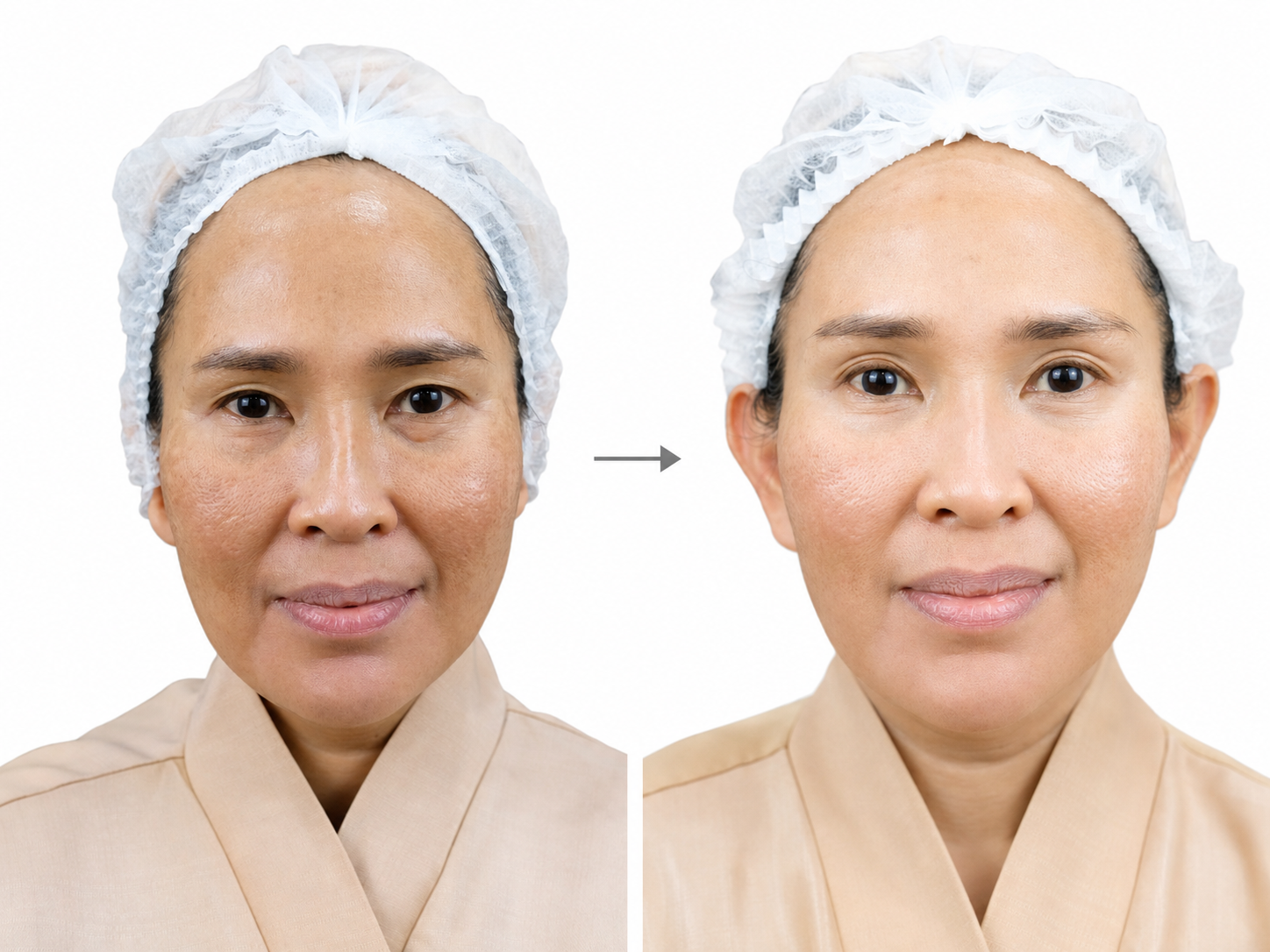 Xelarederm - Gambar 2