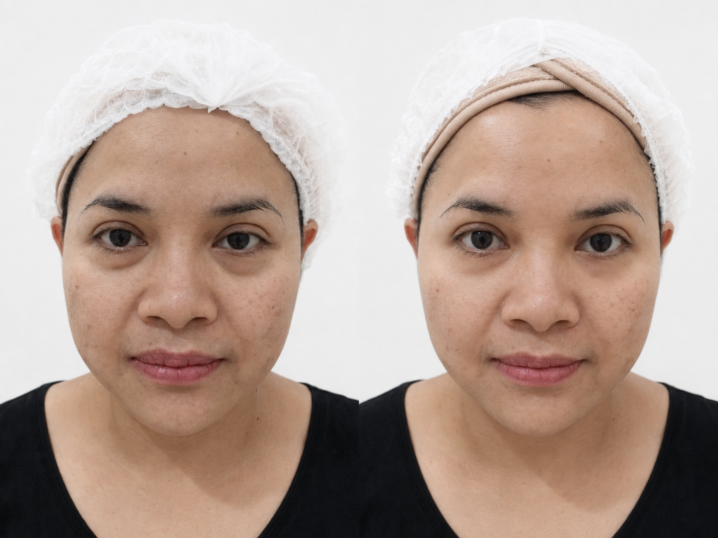 Hollywood Face Sculpting