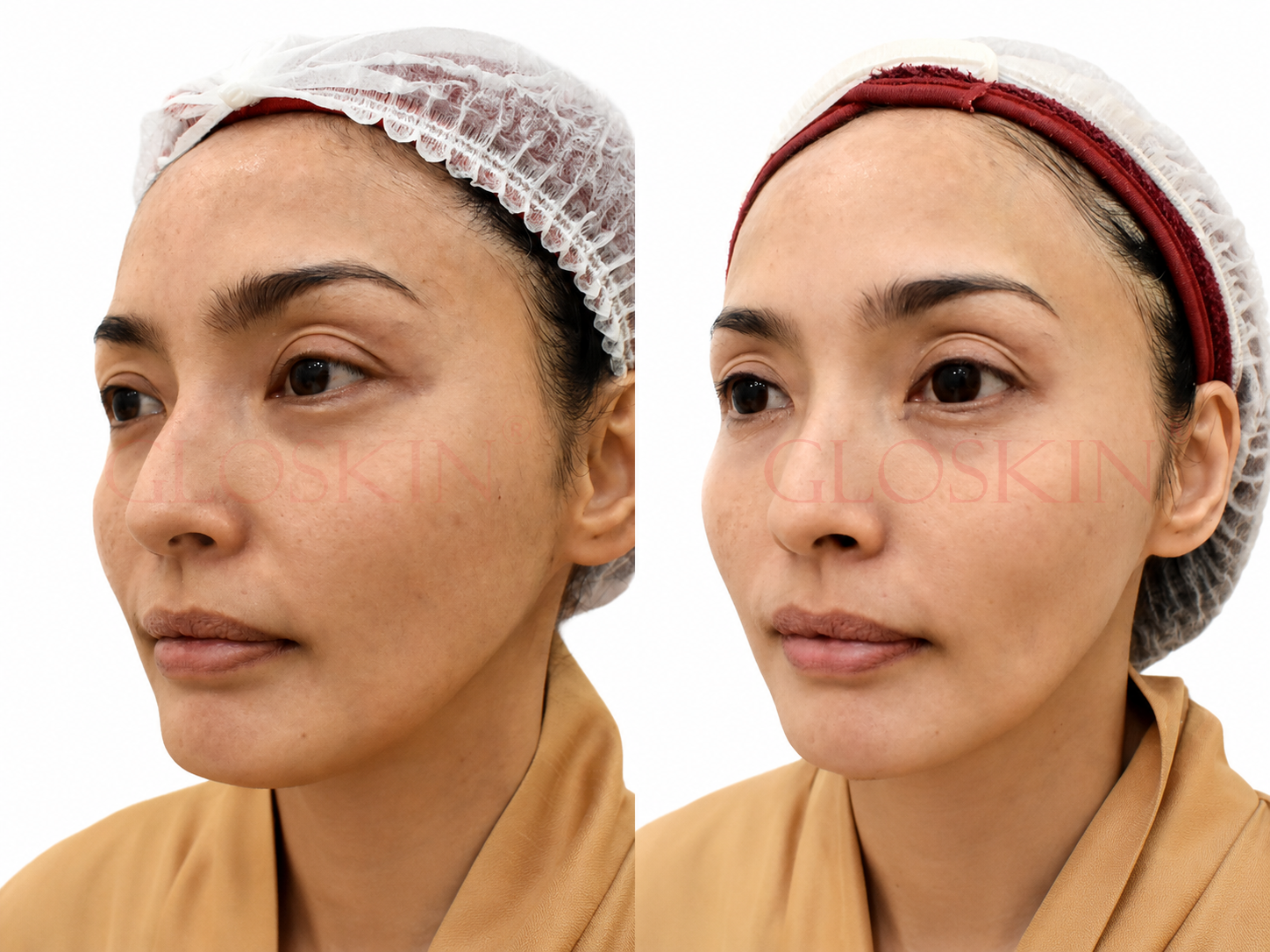 Korean Comedo Glowing Peel