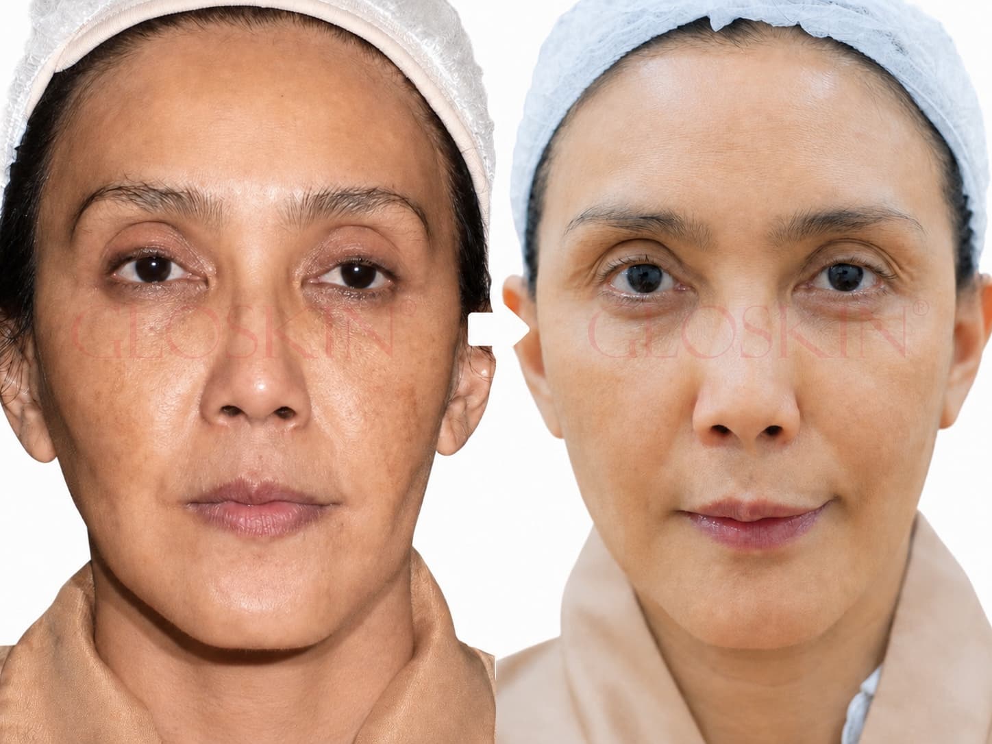 Skinvive