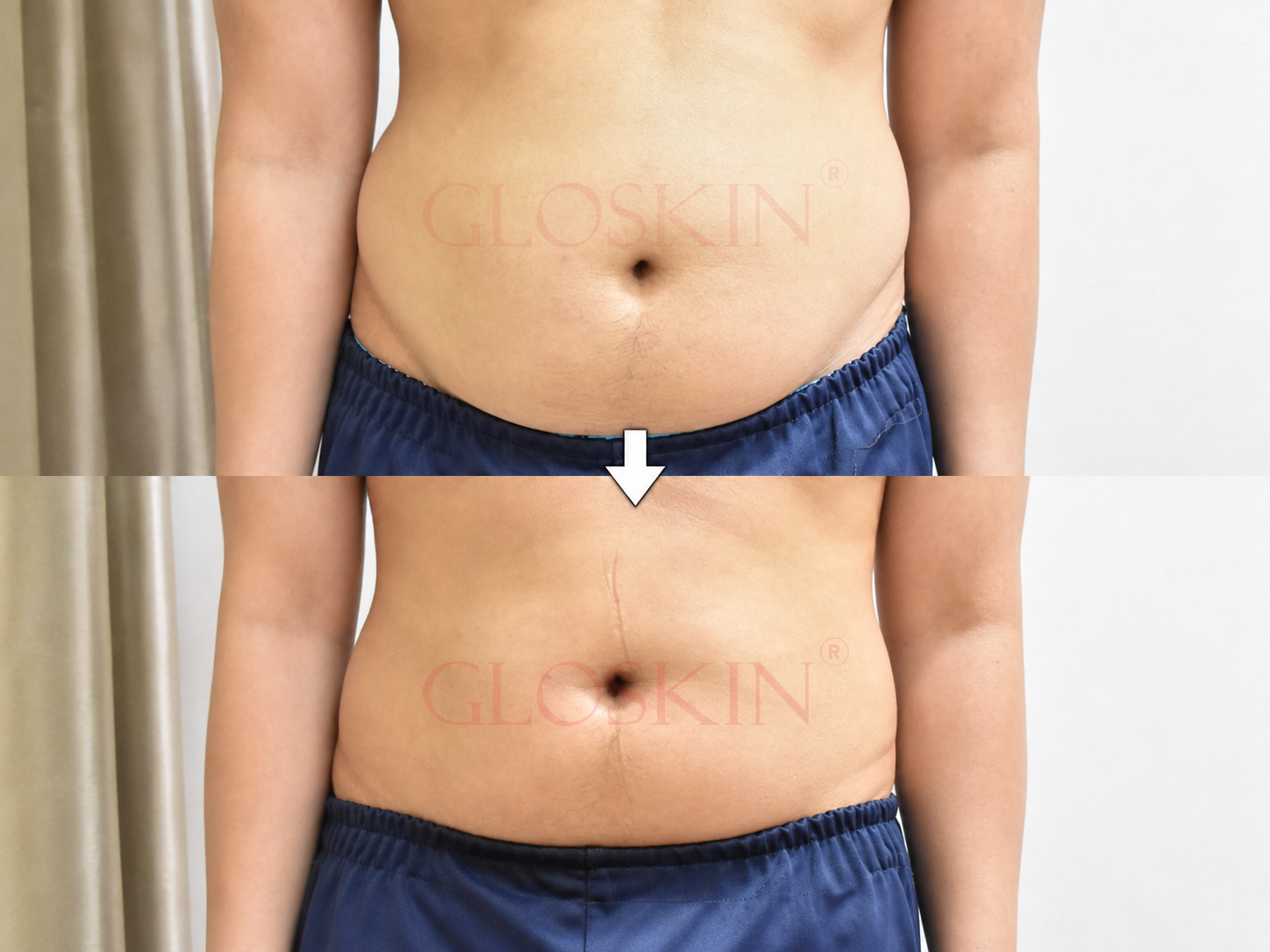 Hollywood Body Sculpting - Gambar 2