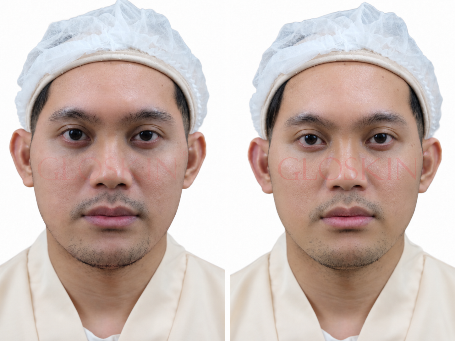 Hydra Glowing Luxury Facial Therapy