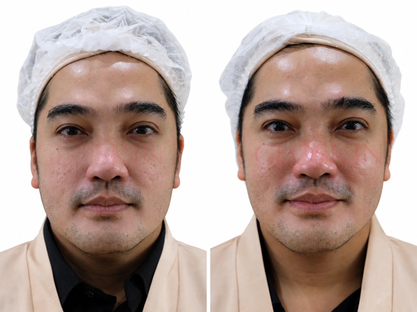 Luxury Face Therapy